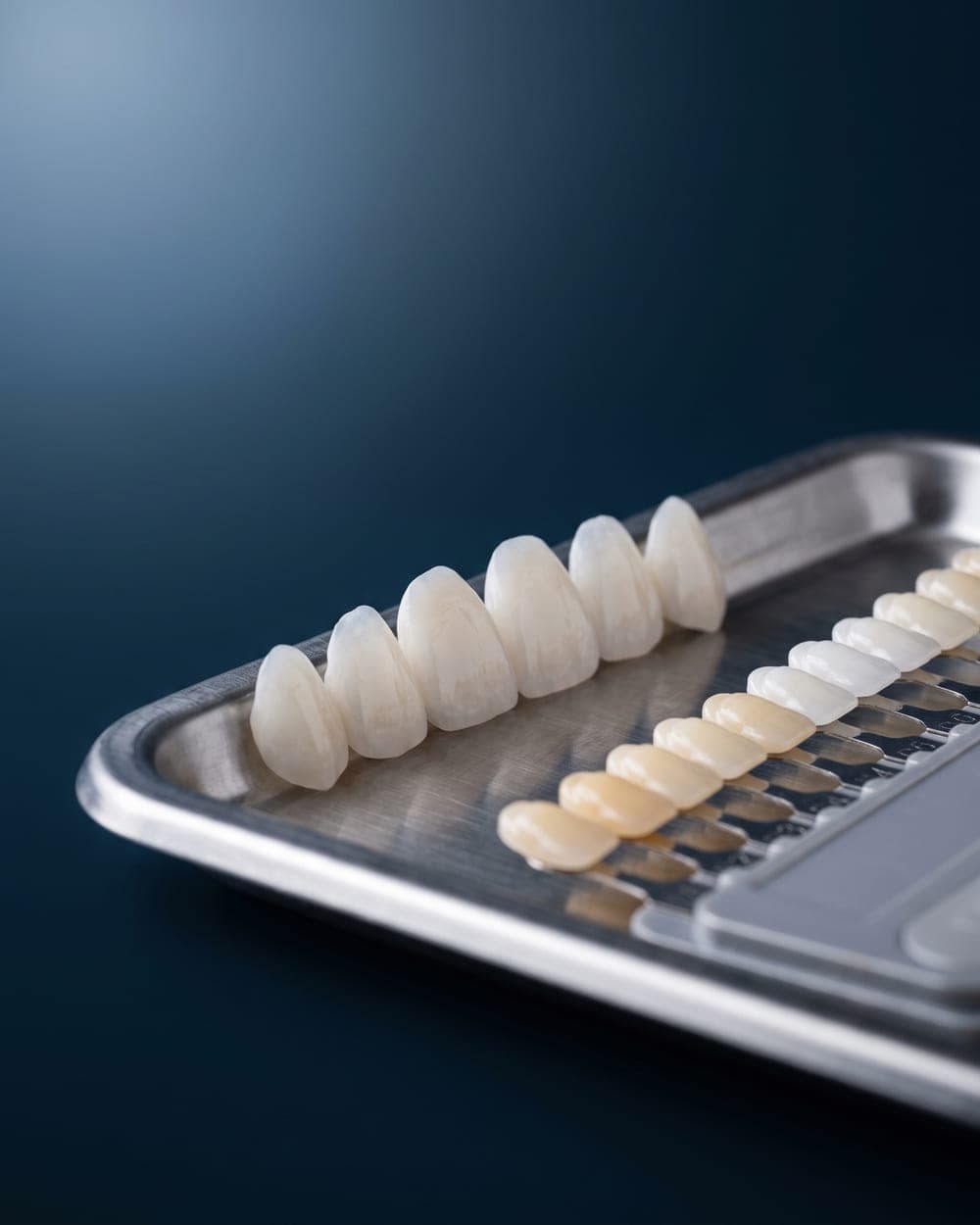 Carillas de porcelana alineadas junto a una guía de color dental sobre charola de acero